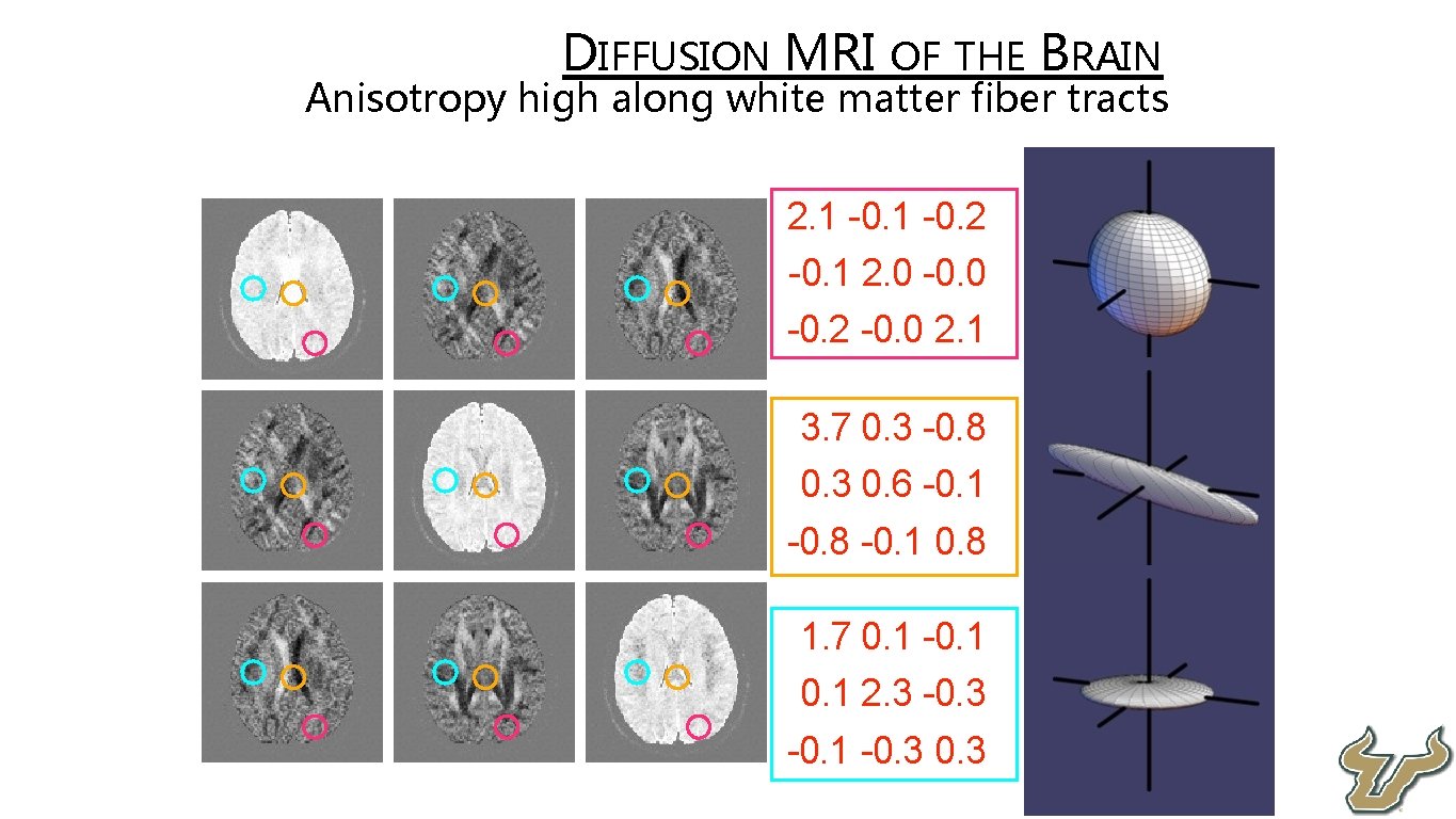  • • DIFFUSION MRI OF THE BRAIN Anisotropy high along white matter fiber