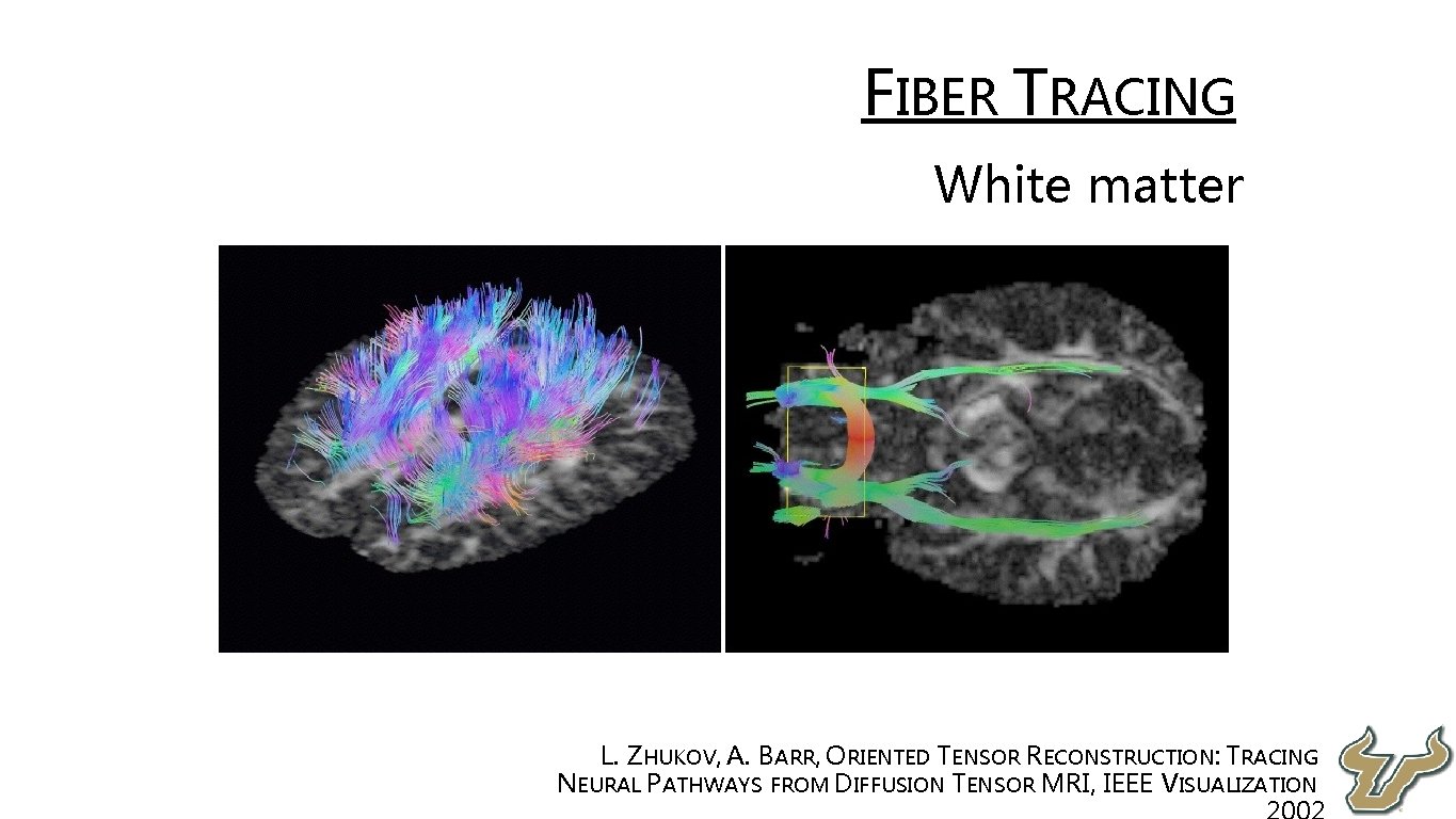  • FIBER TRACING • White matter • L. ZHUKOV, A. BARR, ORIENTED TENSOR