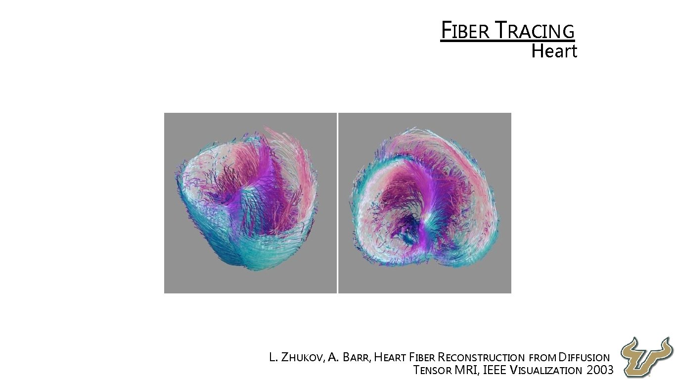  • FIBER TRACING • Heart • L. ZHUKOV, A. BARR, HEART FIBER RECONSTRUCTION