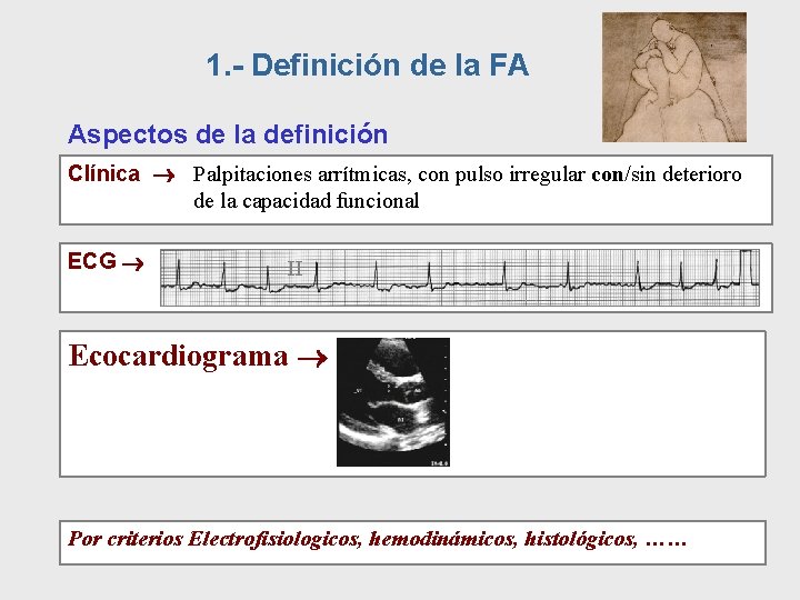 1. - Definición de la FA Aspectos de la definición Clínica Palpitaciones arrítmicas, con