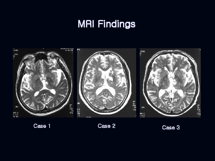 MRI Findings Case 1 Case 2 Case 3 