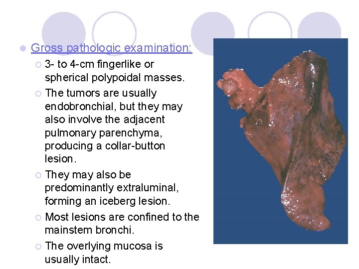 l Gross pathologic examination: 3 - to 4 -cm fingerlike or spherical polypoidal masses. l Gross pathologic examination: 3 - to 4 -cm fingerlike or spherical polypoidal masses.