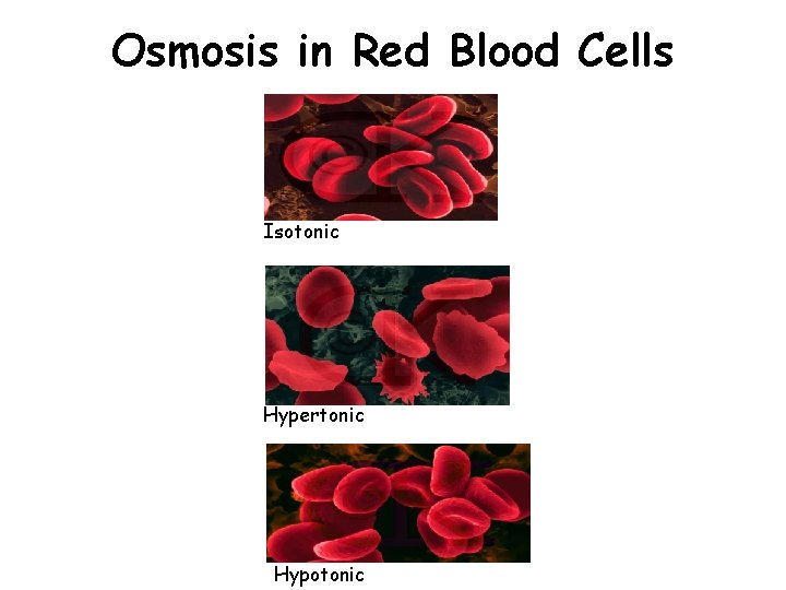 Osmosis in Red Blood Cells Isotonic Hypertonic Hypotonic Osmosis in Red Blood Cells Isotonic Hypertonic Hypotonic