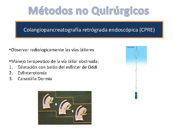 Métodos no Quirúrgicos Colangiopancreatografía retrógrada endoscópica (CPRE) • Observar radiologicamente las vías biliares • Métodos no Quirúrgicos Colangiopancreatografía retrógrada endoscópica (CPRE) • Observar radiologicamente las vías biliares •