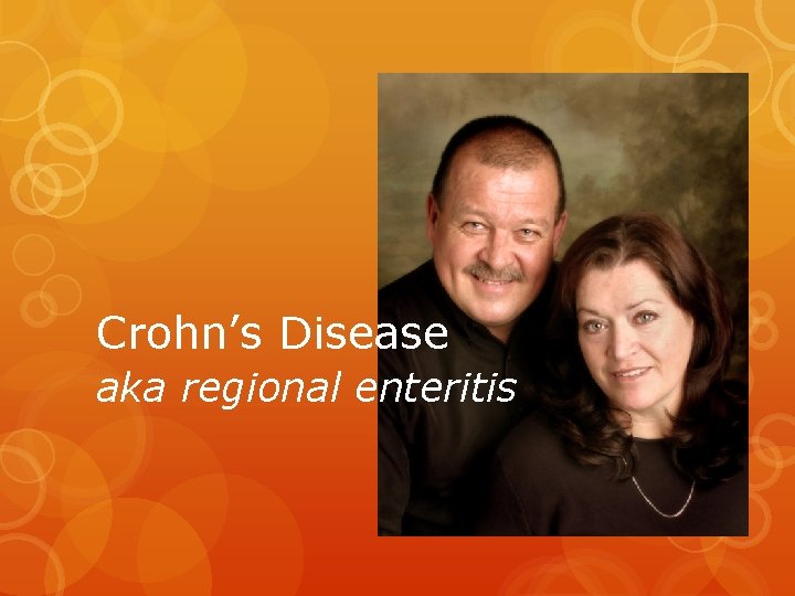 Crohn’s Disease aka regional enteritis 