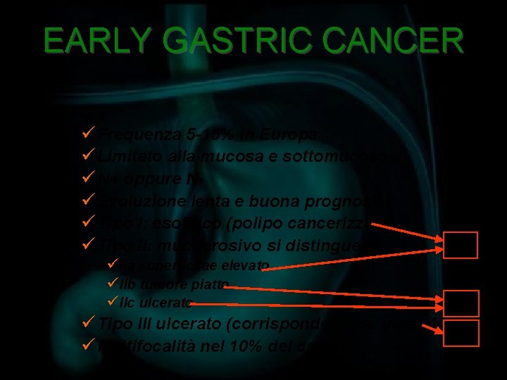 EARLY GASTRIC CANCER ü Frequenza 5 -15% in Europa ü Limitato alla mucosa e