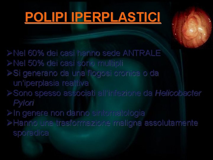 POLIPI IPERPLASTICI ØNel 60% dei casi hanno sede ANTRALE ØNel 50% dei casi sono