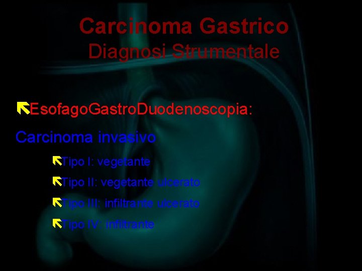 Carcinoma Gastrico Diagnosi Strumentale ëEsofago. Gastro. Duodenoscopia: Carcinoma invasivo ëTipo I: vegetante ëTipo II: