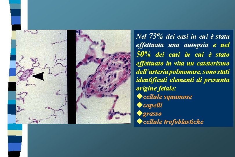 Nel 73% dei casi in cui è stata effettuata una autopsia e nel 50%