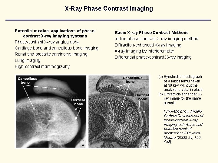 X-Ray Phase Contrast Imaging Potential medical applications of phasecontrast X-ray imaging systems Phase-contrast X-ray