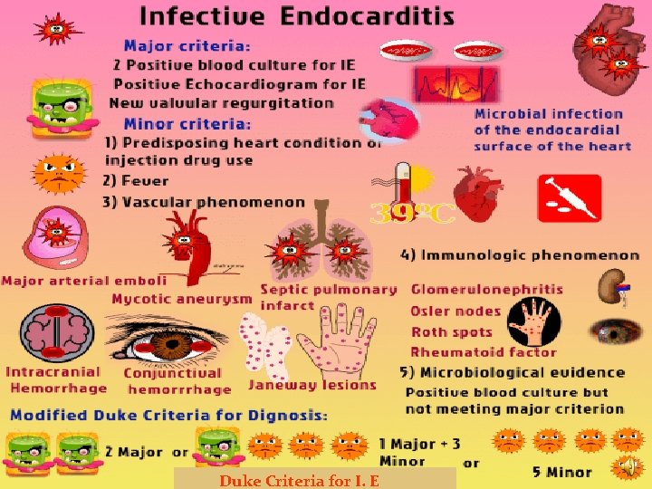 Duke Criteria for I. E 