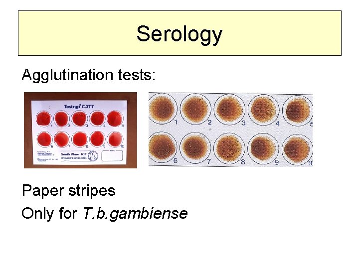 Serology Agglutination tests: Paper stripes Only for T. b. gambiense 