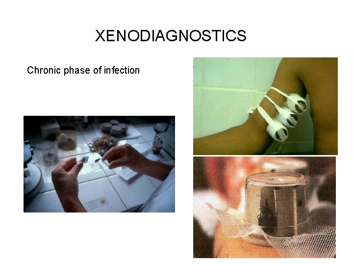 XENODIAGNOSTICS Chronic phase of infection 