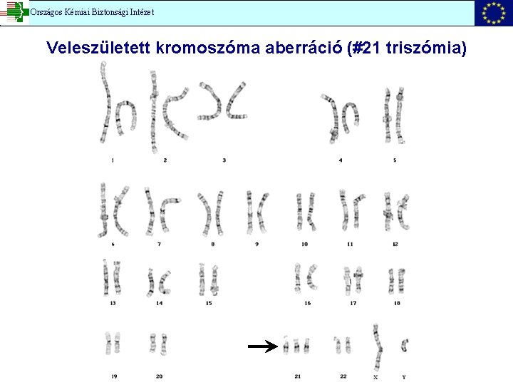 Országos Kémiai Biztonsági Intézet Veleszületett kromoszóma aberráció (#21 triszómia) 