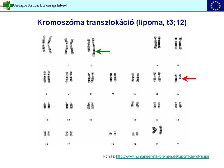 Országos Kémiai Biztonsági Intézet Kromoszóma transzlokáció (lipoma, t 3; 12) Forrás: http: //www. humangenetik-bremen.