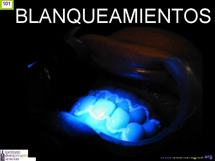 101 BLANQUEAMIENTOS www. odontologico. org 