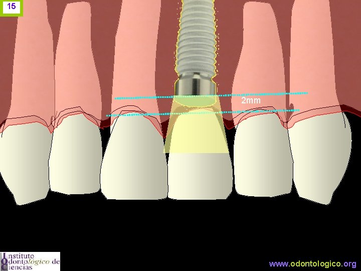 15 2 mm www. odontologico. org 