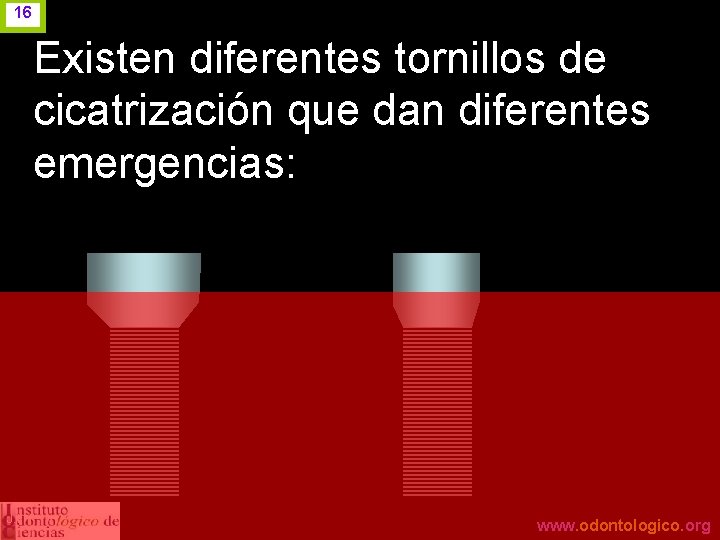16 Existen diferentes tornillos de cicatrización que dan diferentes emergencias: J. I. H. www.