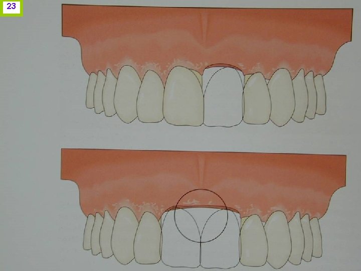 23 J. I. H. www. odontologico. org 