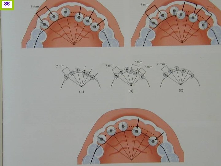36 J. I. H. www. odontologico. org 