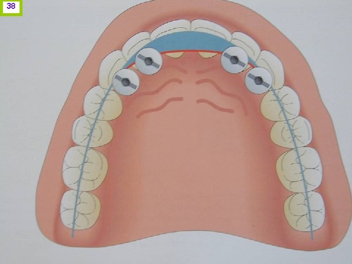 38 J. I. H. www. odontologico. org 