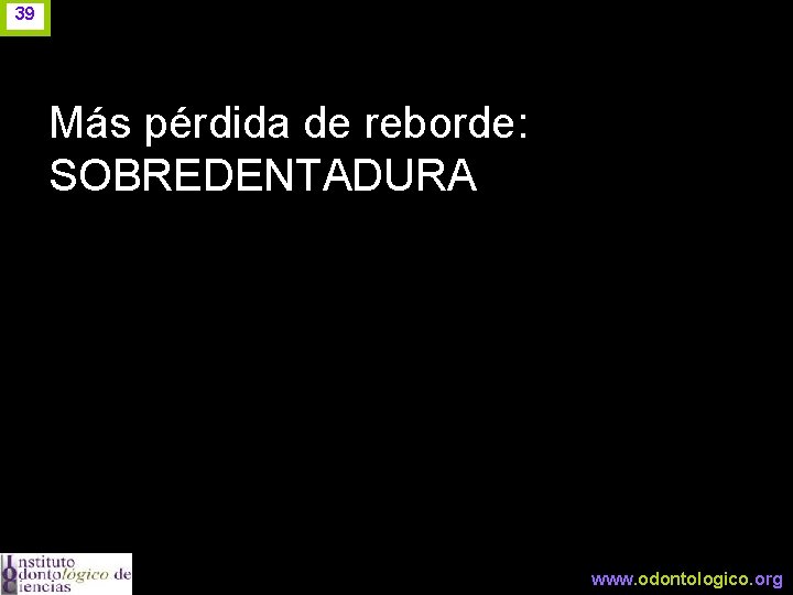 39 Más pérdida de reborde: SOBREDENTADURA www. odontologico. org 