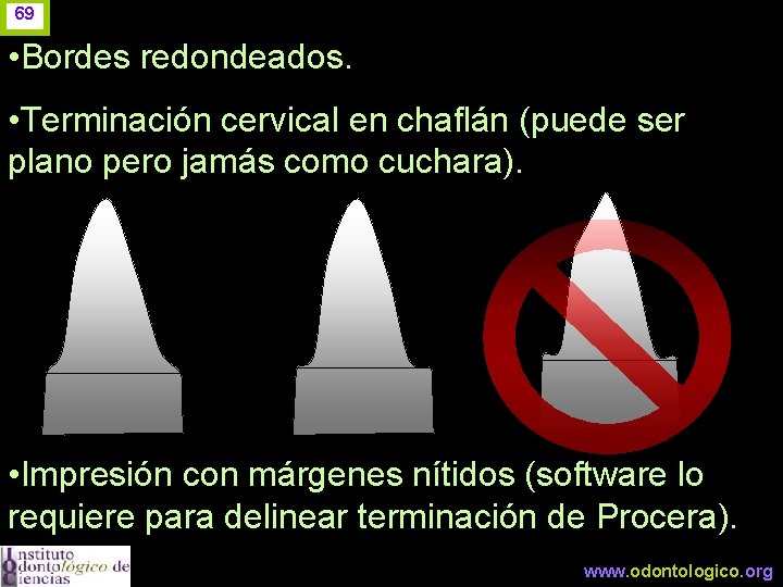 69 • Bordes redondeados. • Terminación cervical en chaflán (puede ser plano pero jamás