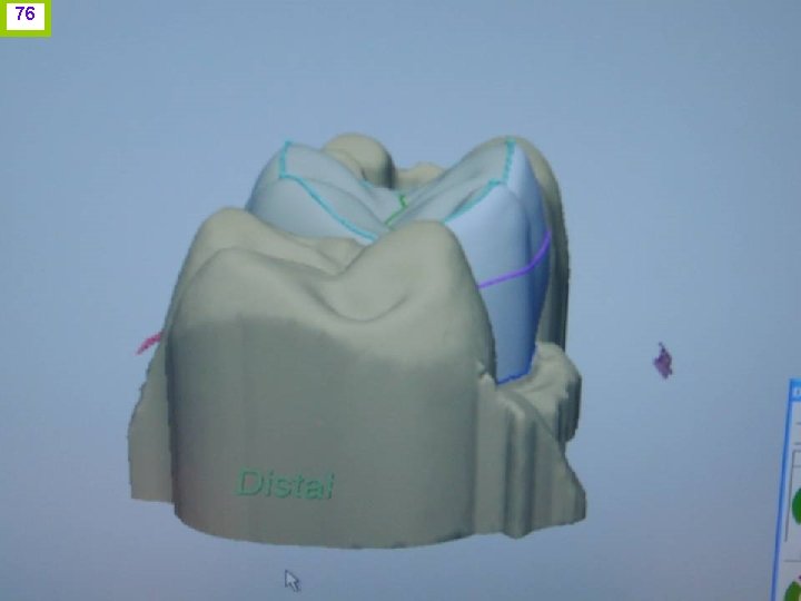 76 J. I. H. www. odontologico. org 