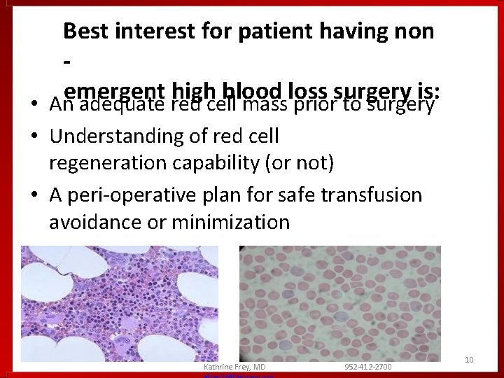 Best interest for patient having non emergent high blood loss surgery is: • An