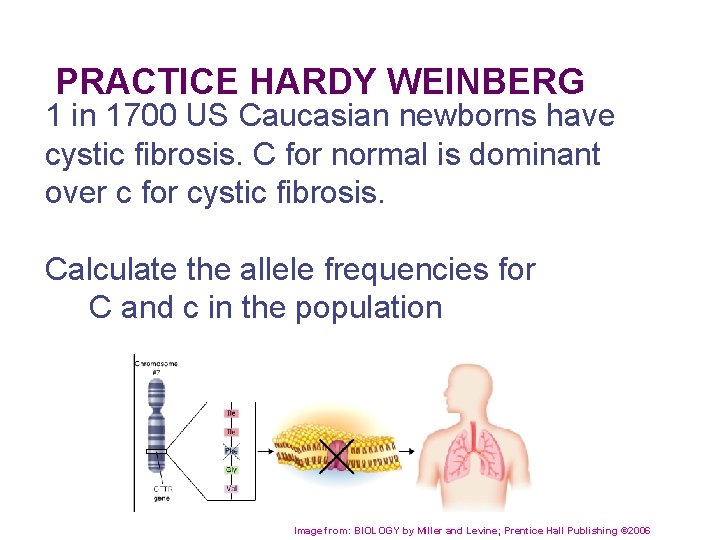 PRACTICE HARDY WEINBERG 1 in 1700 US Caucasian newborns have cystic fibrosis. C for