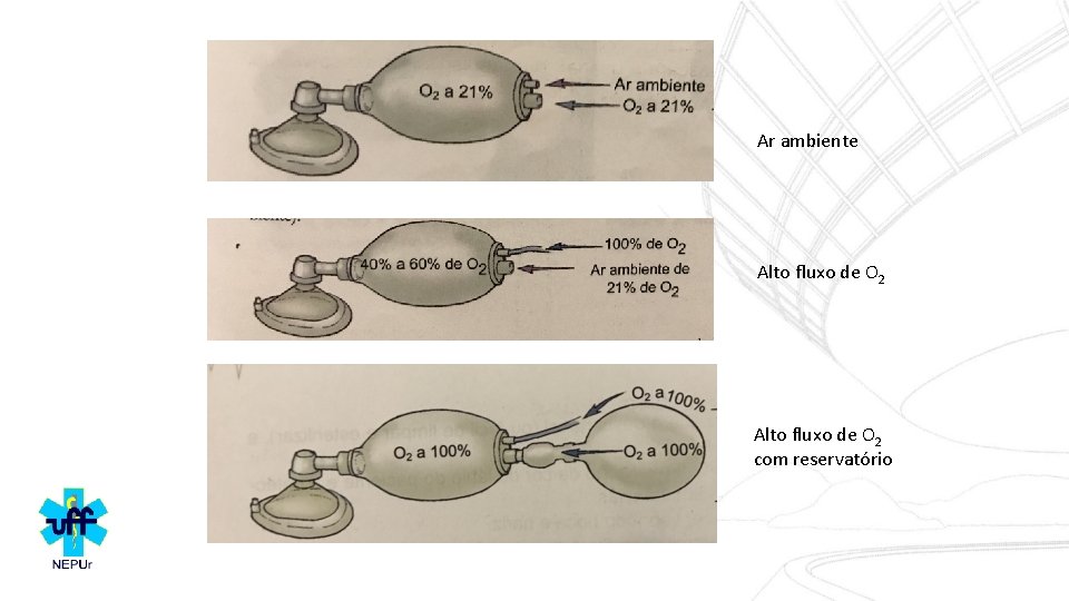 Ar ambiente Alto fluxo de O 2 com reservatório 