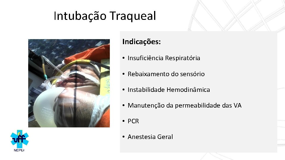 Intubação Traqueal Indicações: • Insuficiência Respiratória • Rebaixamento do sensório • Instabilidade Hemodinâmica •