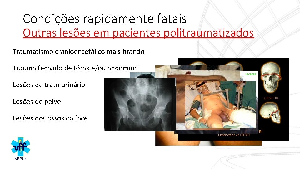 Condições rapidamente fatais Outras lesões em pacientes politraumatizados Traumatismo cranioencefálico mais brando Trauma fechado