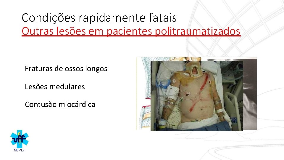 Condições rapidamente fatais Outras lesões em pacientes politraumatizados Fraturas de ossos longos Lesões medulares