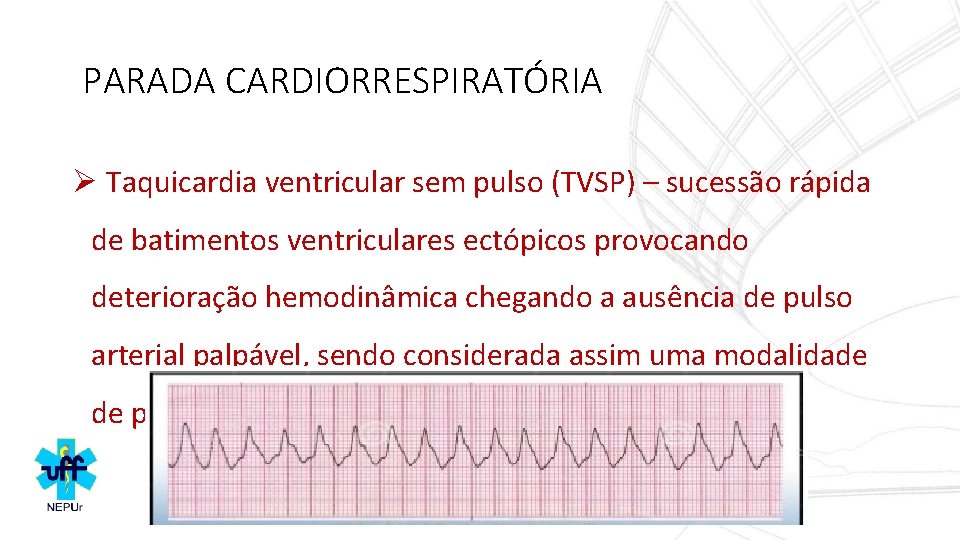 PARADA CARDIORRESPIRATÓRIA Ø Taquicardia ventricular sem pulso (TVSP) – sucessão rápida de batimentos ventriculares