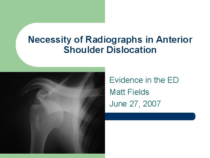 Necessity of Radiographs in Anterior Shoulder Dislocation Evidence in the ED Matt Fields June