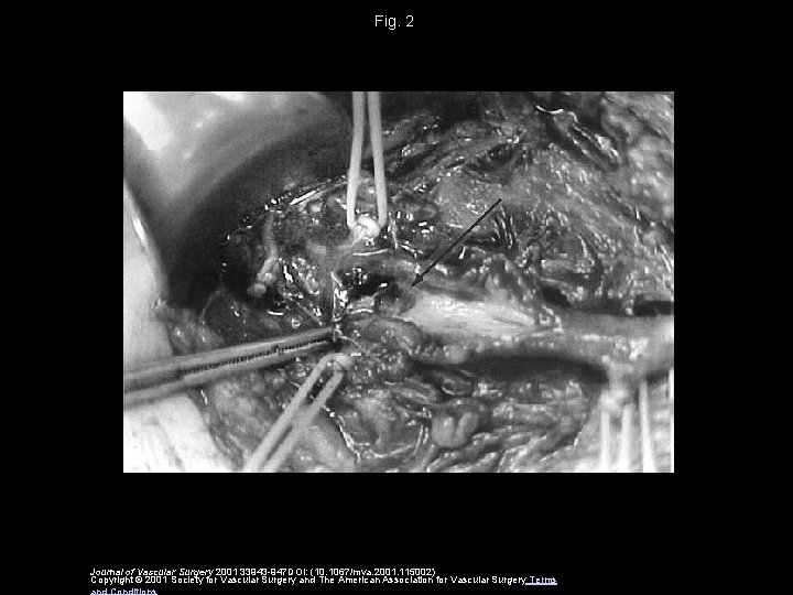 Fig. 2 Journal of Vascular Surgery 2001 33943 -947 DOI: (10. 1067/mva. 2001. 115002)