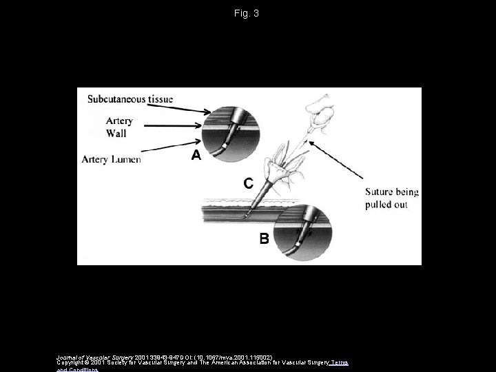 Fig. 3 Journal of Vascular Surgery 2001 33943 -947 DOI: (10. 1067/mva. 2001. 115002)