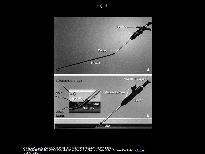 Fig. 4 Journal of Vascular Surgery 2001 33943 -947 DOI: (10. 1067/mva. 2001. 115002)