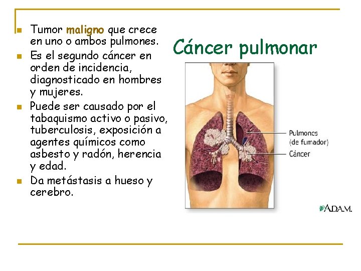 n n Tumor maligno que crece en uno o ambos pulmones. Es el segundo