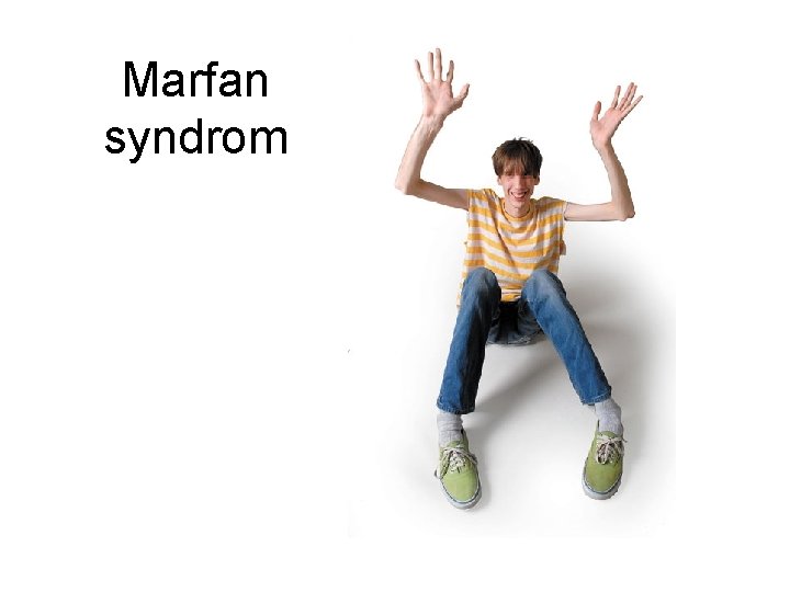 Marfan syndrom 