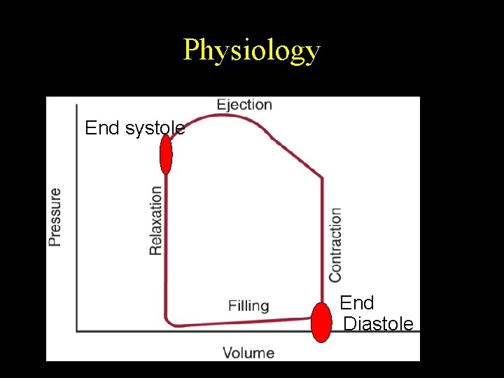 Physiology End systole End Diastole 