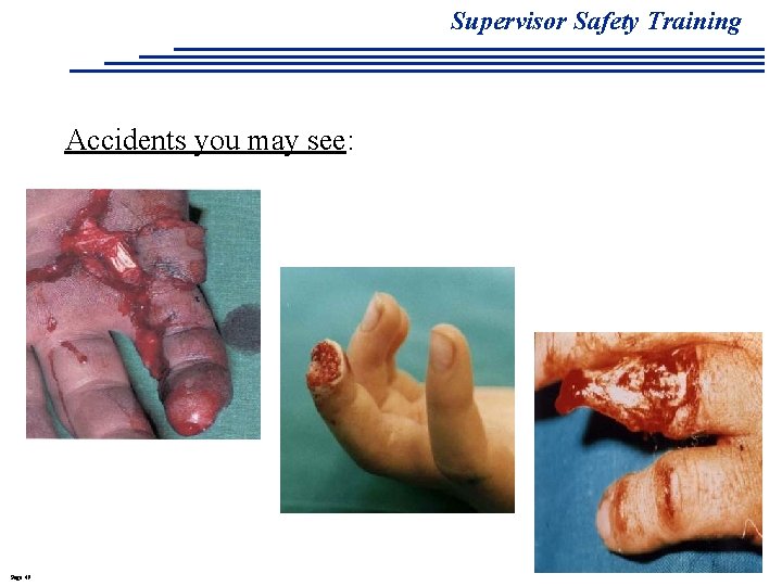 Supervisor Safety Training Accidents you may see: Page 49 