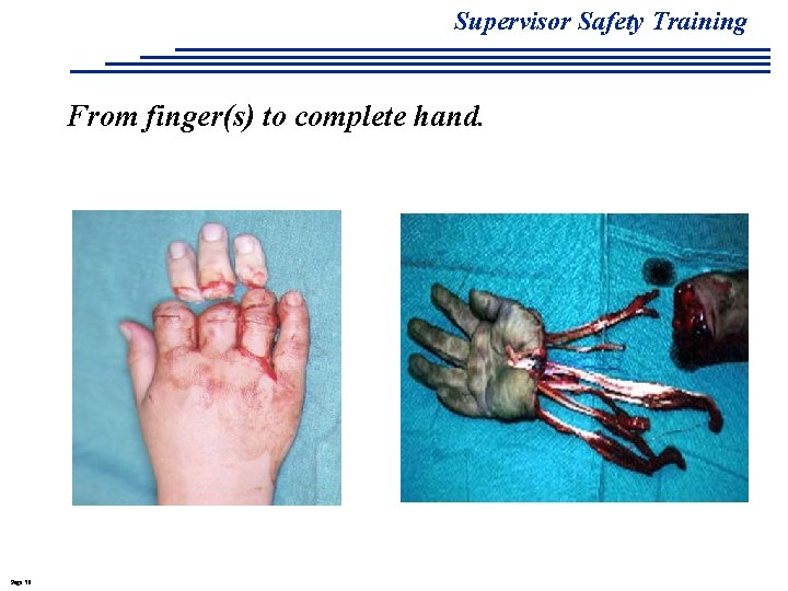 Supervisor Safety Training From finger(s) to complete hand. Page 50 