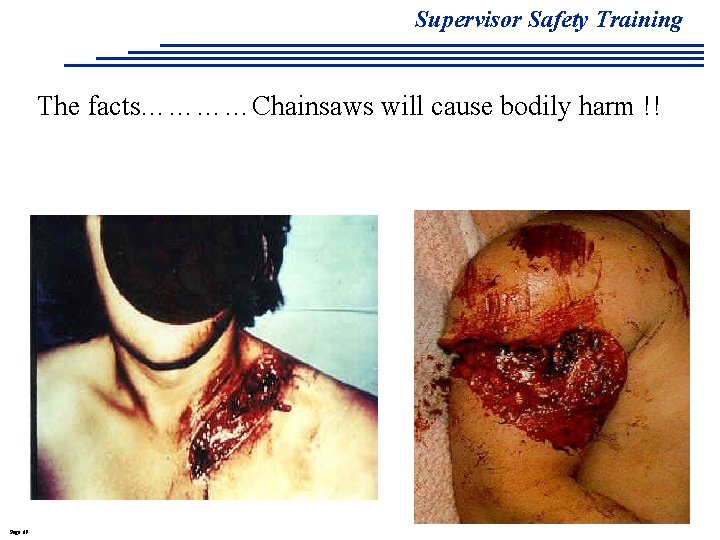 Supervisor Safety Training The facts…………Chainsaws will cause bodily harm !! Page 69 