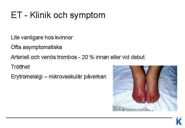 ET - Klinik och symptom Lite vanligare hos kvinnor Ofta asymptomatiska Arteriell och venös