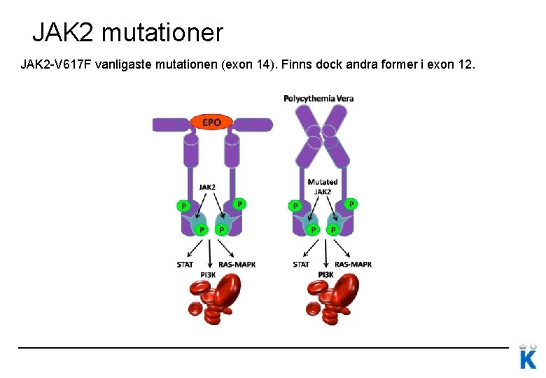 JAK 2 mutationer JAK 2 -V 617 F vanligaste mutationen (exon 14). Finns dock