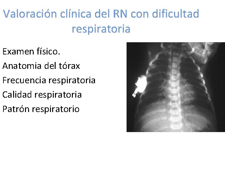 Valoración clínica del RN con dificultad respiratoria Examen físico. Anatomia del tórax Frecuencia respiratoria Valoración clínica del RN con dificultad respiratoria Examen físico. Anatomia del tórax Frecuencia respiratoria