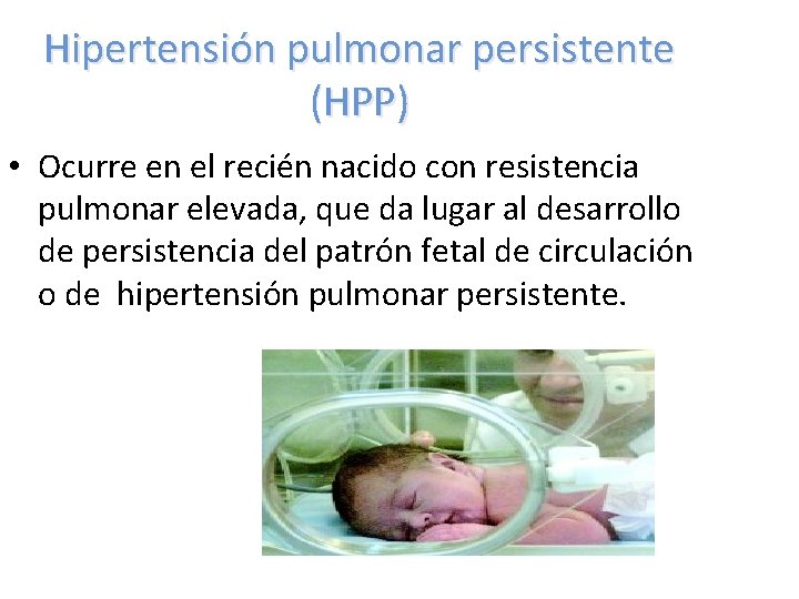 Hipertensión pulmonar persistente (HPP) • Ocurre en el recién nacido con resistencia pulmonar elevada,