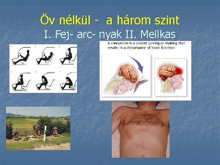 Öv nélkül - a három szint I. Fej- arc- nyak II. Mellkas 